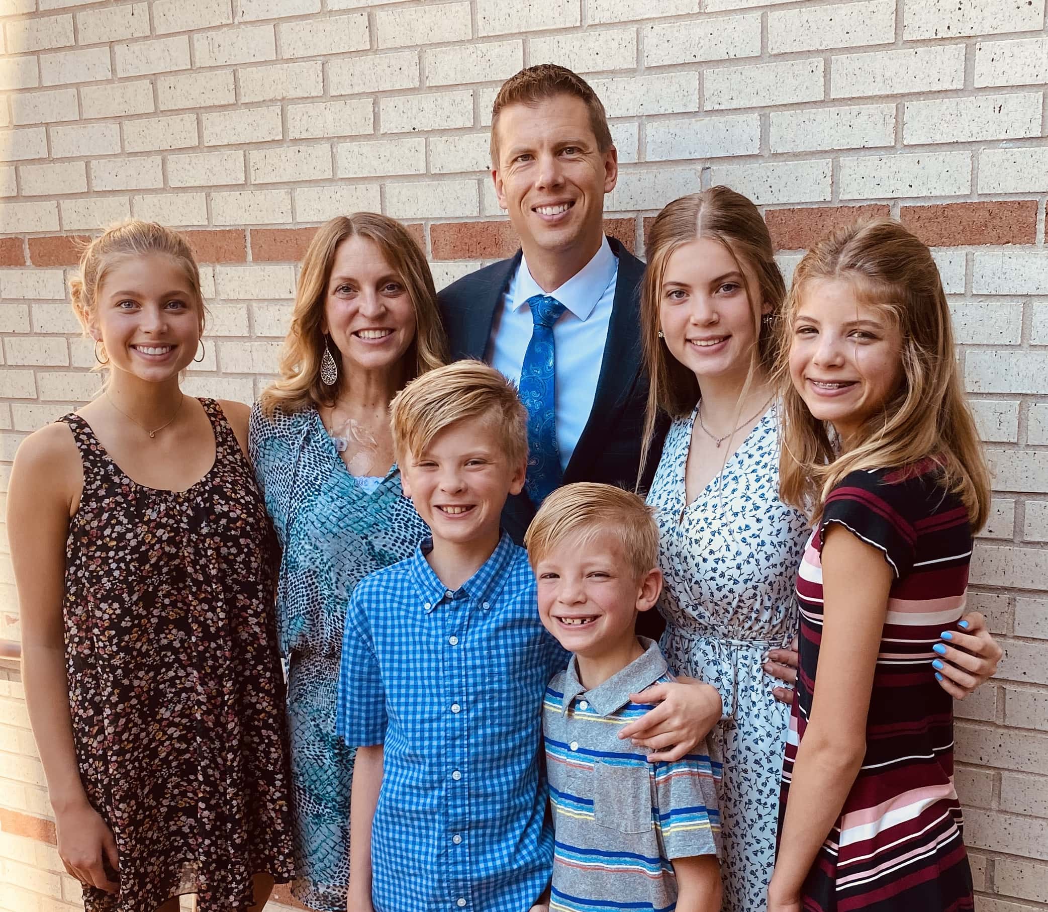 Bonding - Central Park Dentistry of Sheffield, Iowa